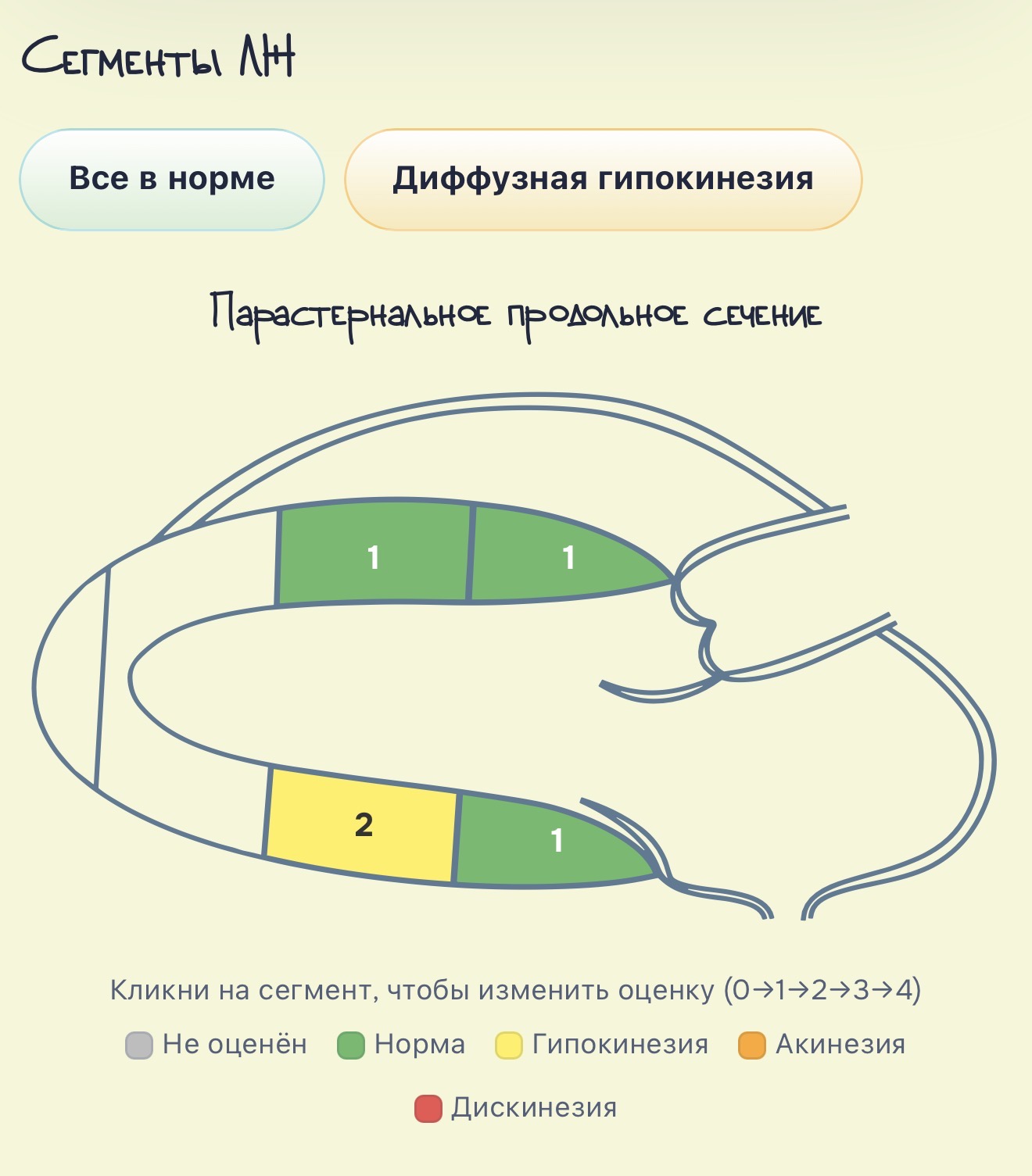 Интерактивная оценка сегментов левого желудочка